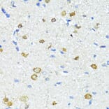 Immunohistochemistry - Anti-Nestin Antibody (A81194) - Antibodies.com