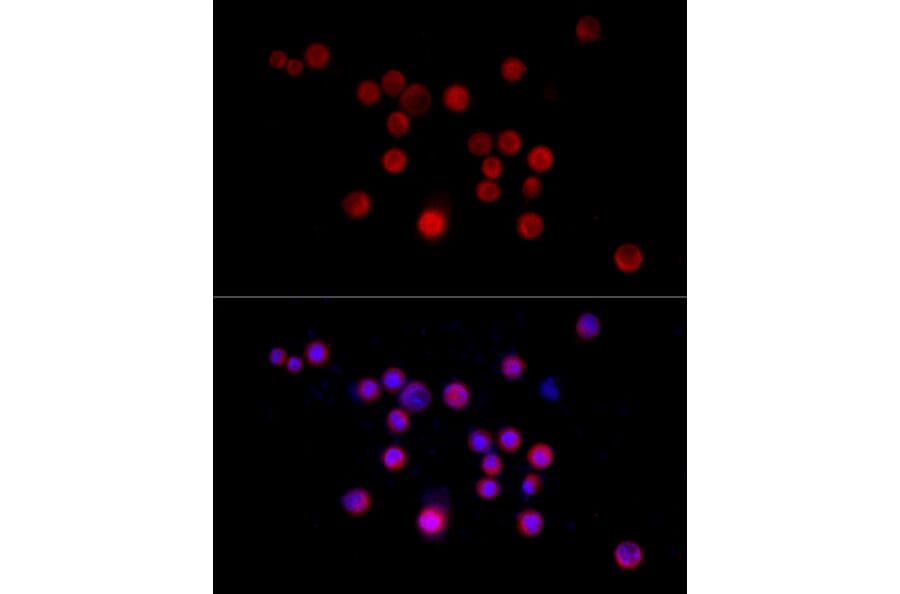 Immunofluorescence - Anti-Nestin Antibody (A81194) - Antibodies.com