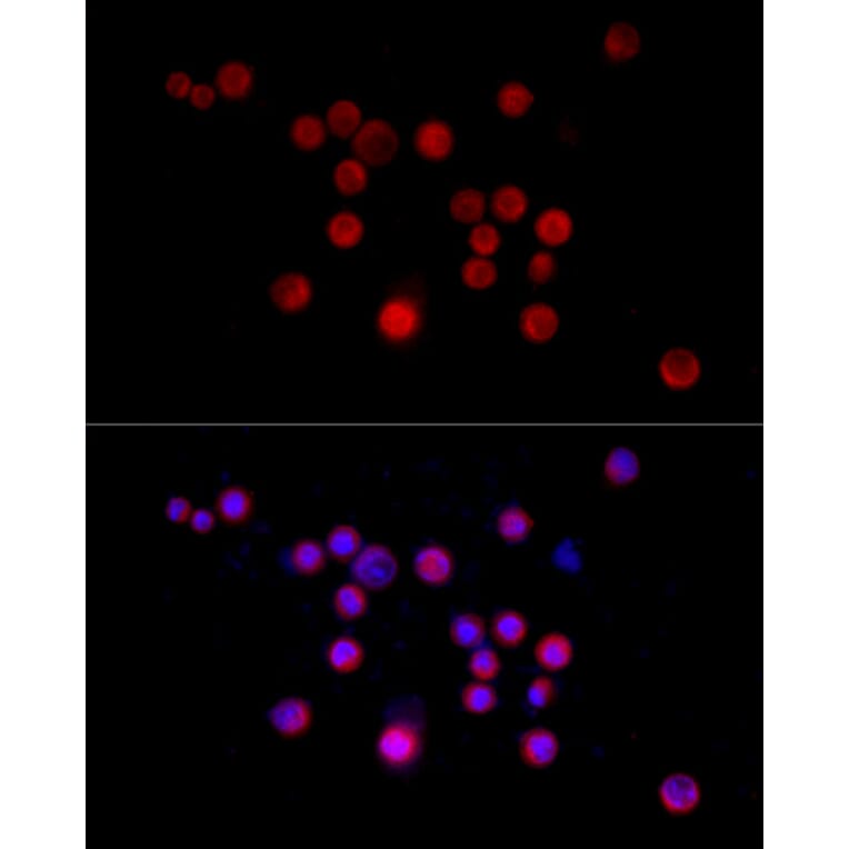 Immunofluorescence - Anti-Nestin Antibody (A81194) - Antibodies.com