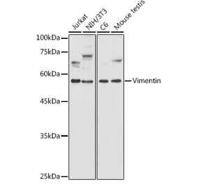 Western Blot - Anti-Vimentin Antibody (A81195) - Antibodies.com