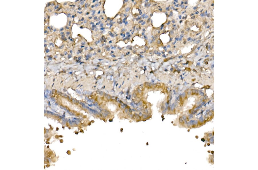 Immunohistochemistry - Anti-Bax Antibody (A81196) - Antibodies.com