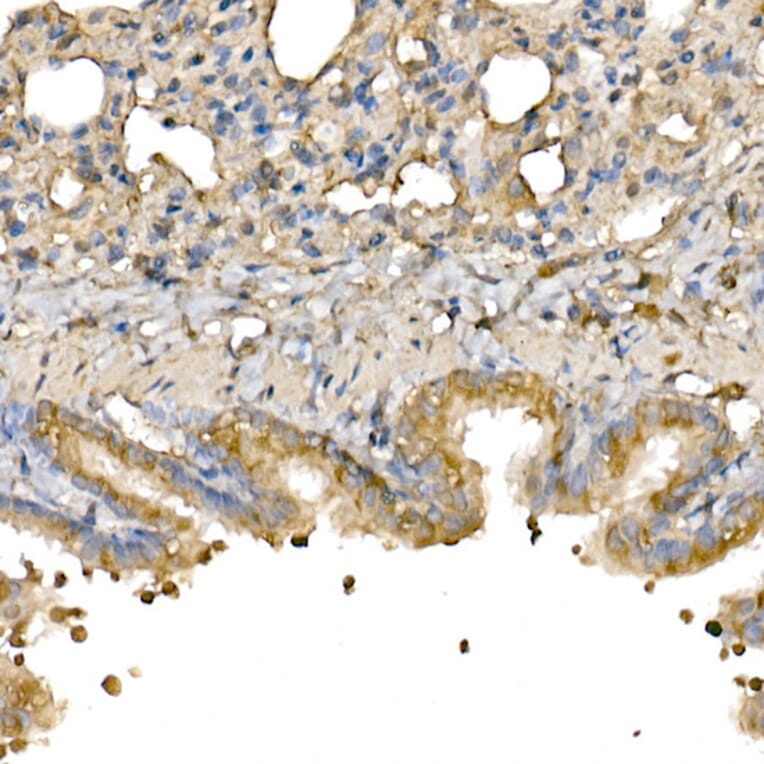 Immunohistochemistry - Anti-Bax Antibody (A81196) - Antibodies.com