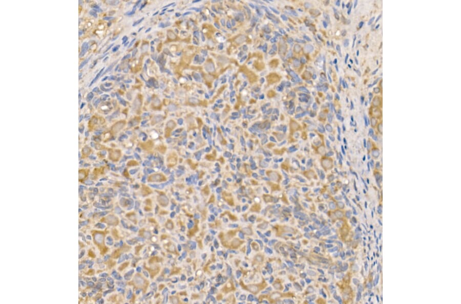 Immunohistochemistry - Anti-Bax Antibody (A81196) - Antibodies.com