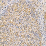 Immunohistochemistry - Anti-Bax Antibody (A81196) - Antibodies.com