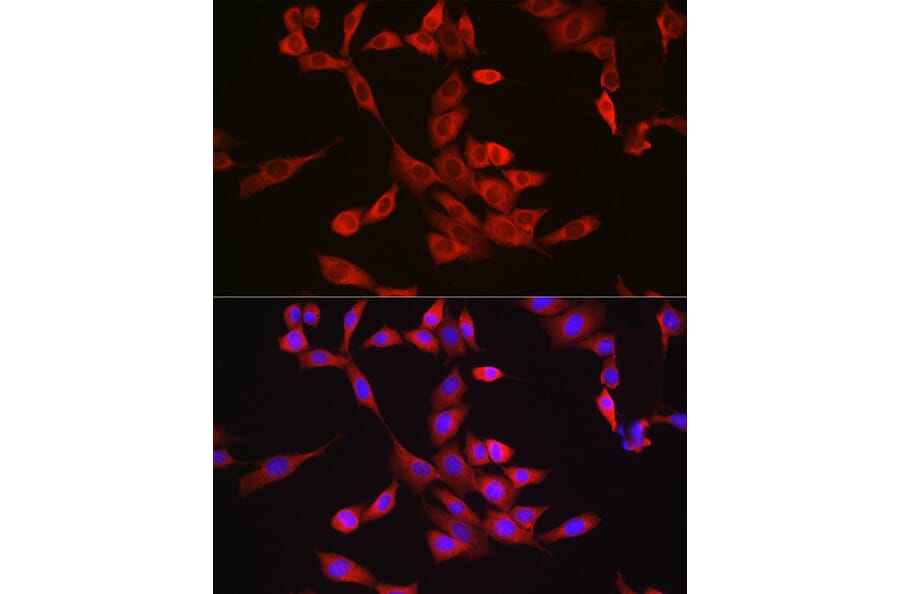 Immunofluorescence - Anti-Bax Antibody (A81196) - Antibodies.com