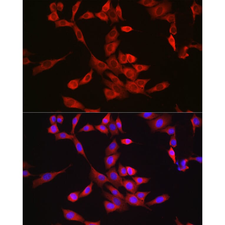 Immunofluorescence - Anti-Bax Antibody (A81196) - Antibodies.com