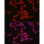 Immunofluorescence - Anti-Bax Antibody (A81196) - Antibodies.com