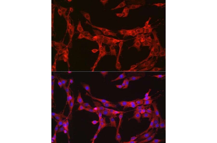 Immunofluorescence - Anti-Bax Antibody (A81196) - Antibodies.com