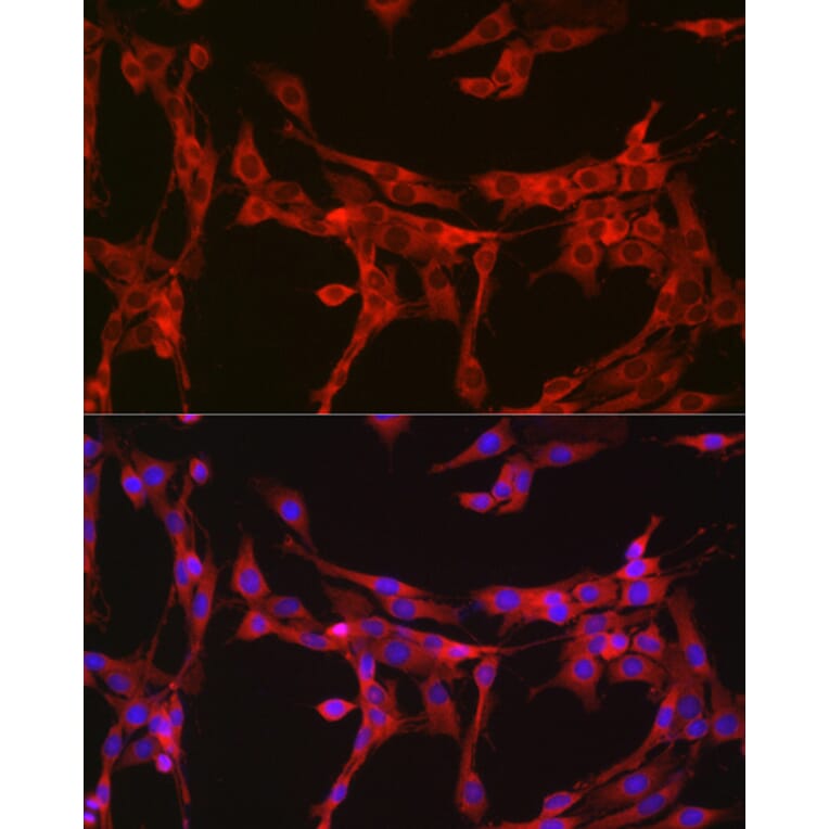 Immunofluorescence - Anti-Bax Antibody (A81196) - Antibodies.com