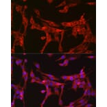 Immunofluorescence - Anti-Bax Antibody (A81196) - Antibodies.com