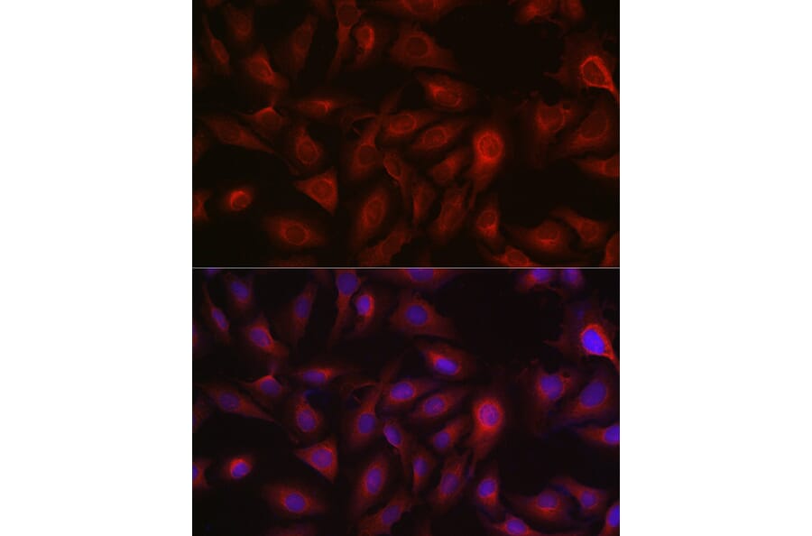 Immunofluorescence - Anti-Bax Antibody (A81196) - Antibodies.com
