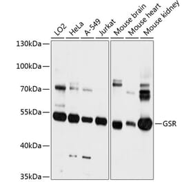 Western Blot - Anti-Glutathione Reductase Antibody (A81197) - Antibodies.com