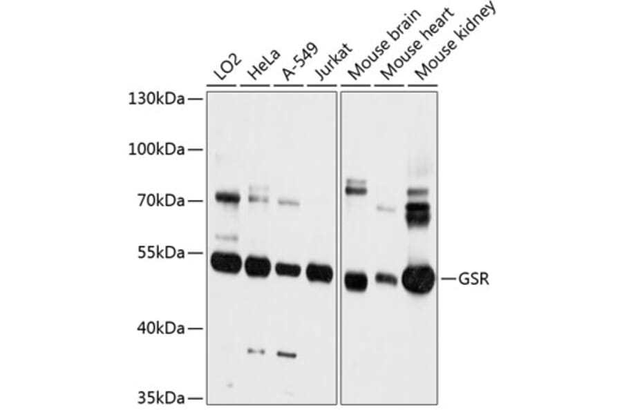 Western Blot - Anti-Glutathione Reductase Antibody (A81197) - Antibodies.com
