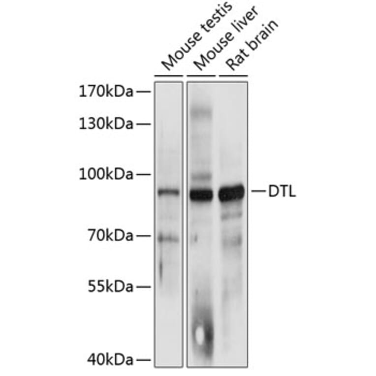 Western Blot - Anti-CDT2/RAMP Antibody (A81198) - Antibodies.com