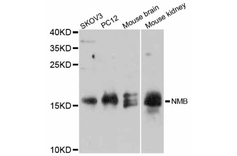 Western Blot - Anti-NMB Antibody (A12158) - Antibodies.com