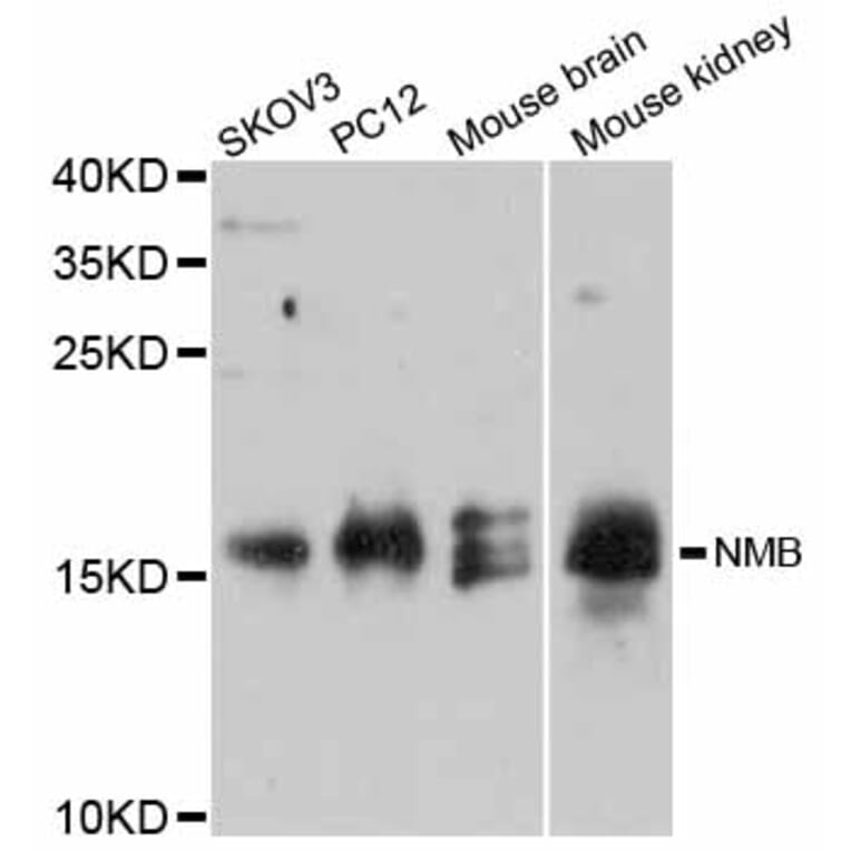 Western Blot - Anti-NMB Antibody (A12158) - Antibodies.com
