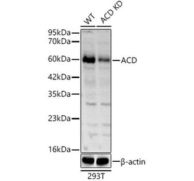Western Blot - Anti-ACD Antibody (A81200) - Antibodies.com