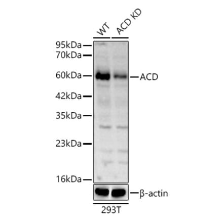 Western Blot - Anti-ACD Antibody (A81200) - Antibodies.com