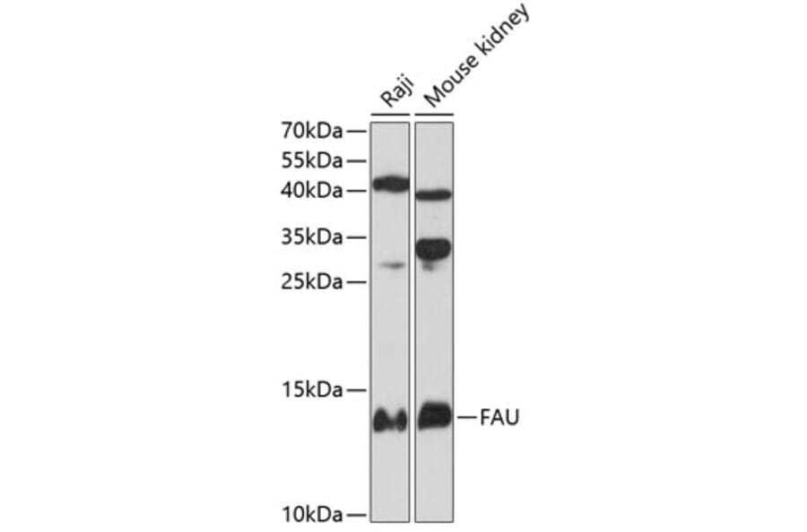 Western Blot - Anti-FAU Antibody (A81201) - Antibodies.com