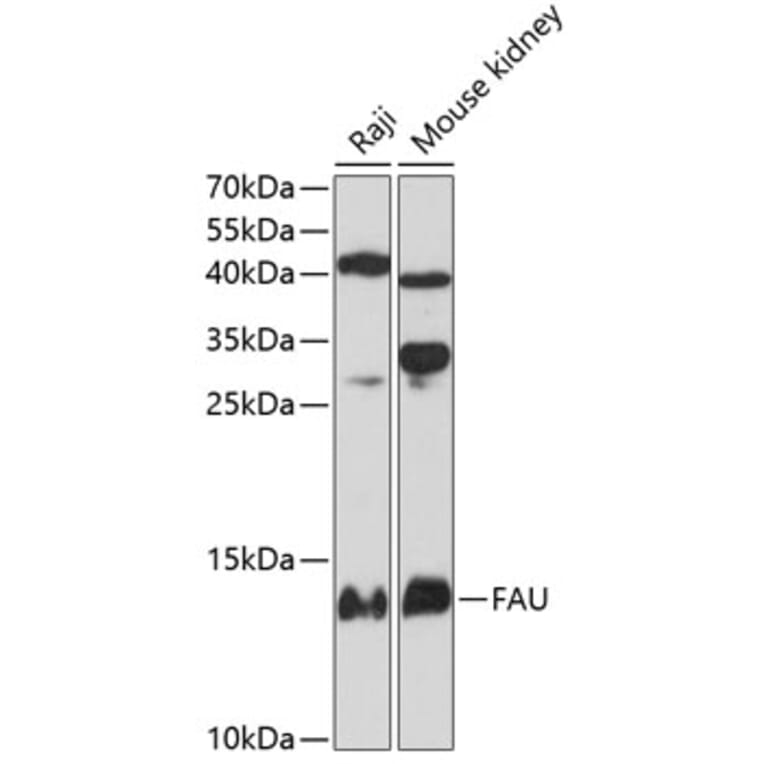 Western Blot - Anti-FAU Antibody (A81201) - Antibodies.com