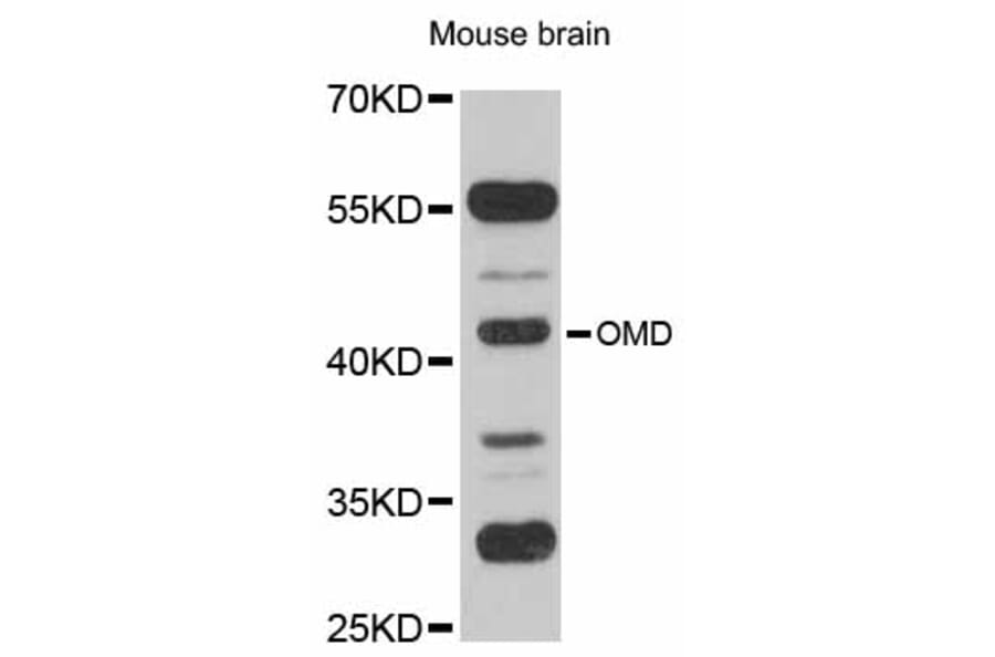 Western Blot - Anti-OMD Antibody (A12256) - Antibodies.com