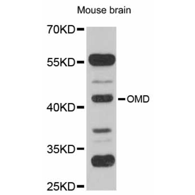 Western Blot - Anti-OMD Antibody (A12256) - Antibodies.com