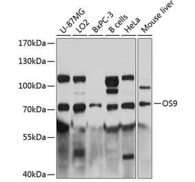 Western Blot - Anti-OS9 Antibody (A81203) - Antibodies.com