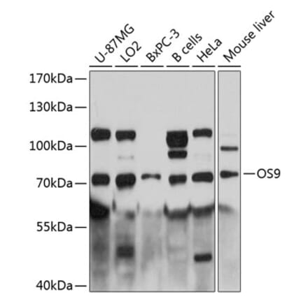 Western Blot - Anti-OS9 Antibody (A81203) - Antibodies.com