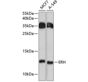 Western Blot - Anti-ERH Antibody (A81204) - Antibodies.com