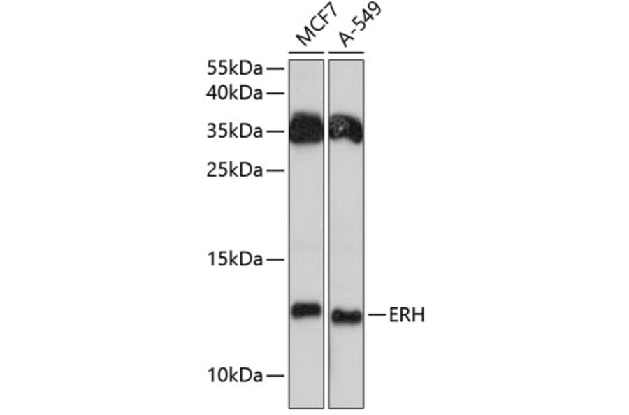 Western Blot - Anti-ERH Antibody (A81204) - Antibodies.com