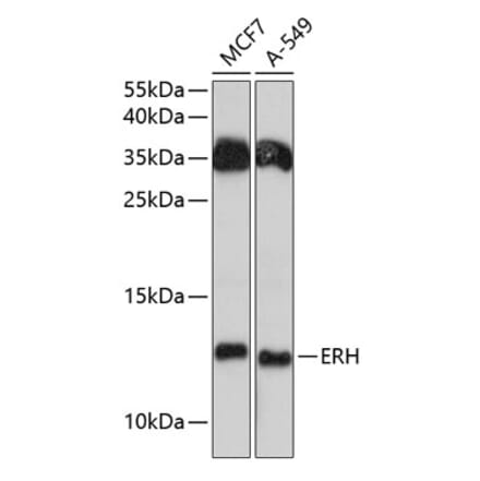 Western Blot - Anti-ERH Antibody (A81204) - Antibodies.com