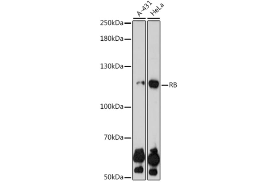 Western Blot - Anti-Rb Antibody (A81205) - Antibodies.com