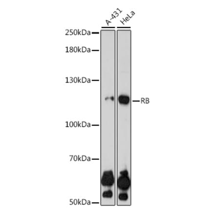 Western Blot - Anti-Rb Antibody (A81205) - Antibodies.com