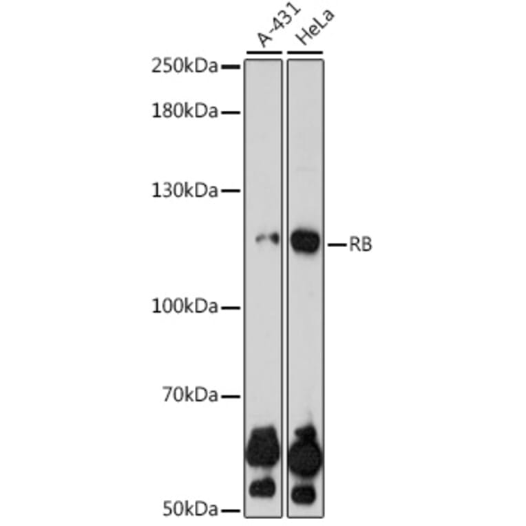 Western Blot - Anti-Rb Antibody (A81205) - Antibodies.com