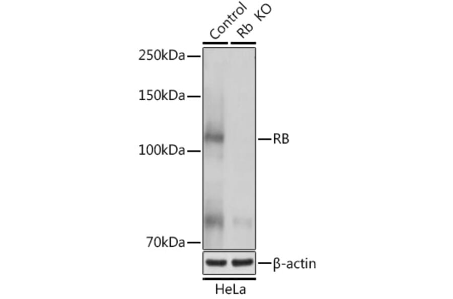 Western Blot - Anti-Rb Antibody (A81205) - Antibodies.com