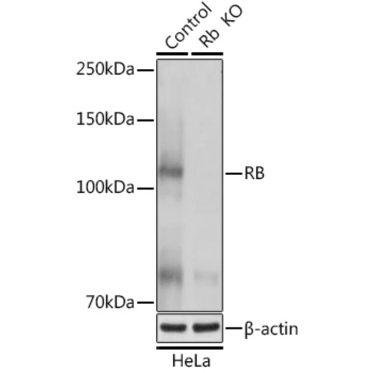 Western Blot - Anti-Rb Antibody (A81205) - Antibodies.com