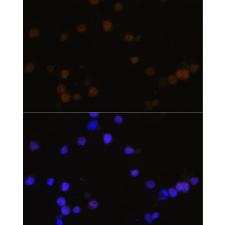 Immunofluorescence - Anti-Rb Antibody (A81205) - Antibodies.com