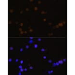 Immunofluorescence - Anti-Rb Antibody (A81205) - Antibodies.com