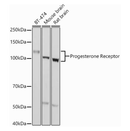 Western Blot - Anti-Progesterone Receptor Antibody (A81206) - Antibodies.com