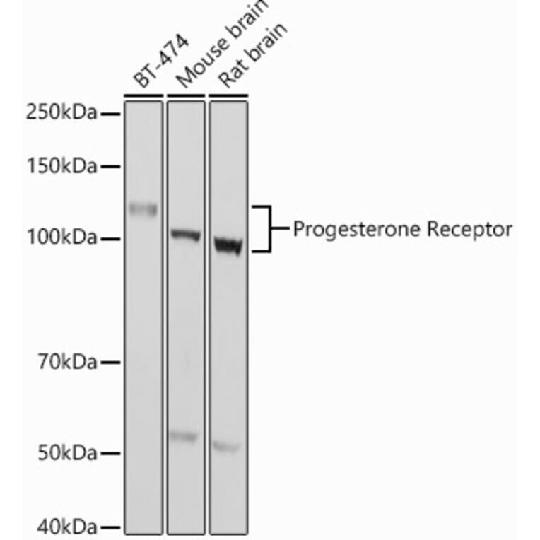Western Blot - Anti-Progesterone Receptor Antibody (A81206) - Antibodies.com