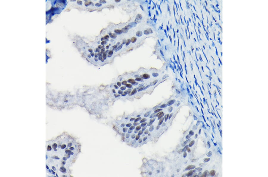 Immunohistochemistry - Anti-Progesterone Receptor Antibody (A81206) - Antibodies.com