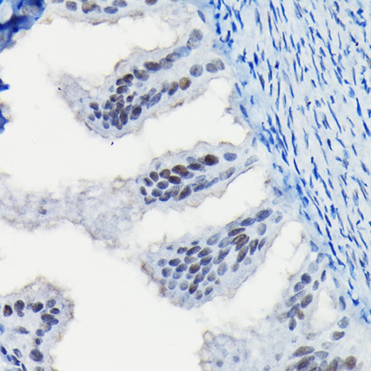 Immunohistochemistry - Anti-Progesterone Receptor Antibody (A81206) - Antibodies.com