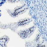Immunohistochemistry - Anti-Progesterone Receptor Antibody (A81206) - Antibodies.com