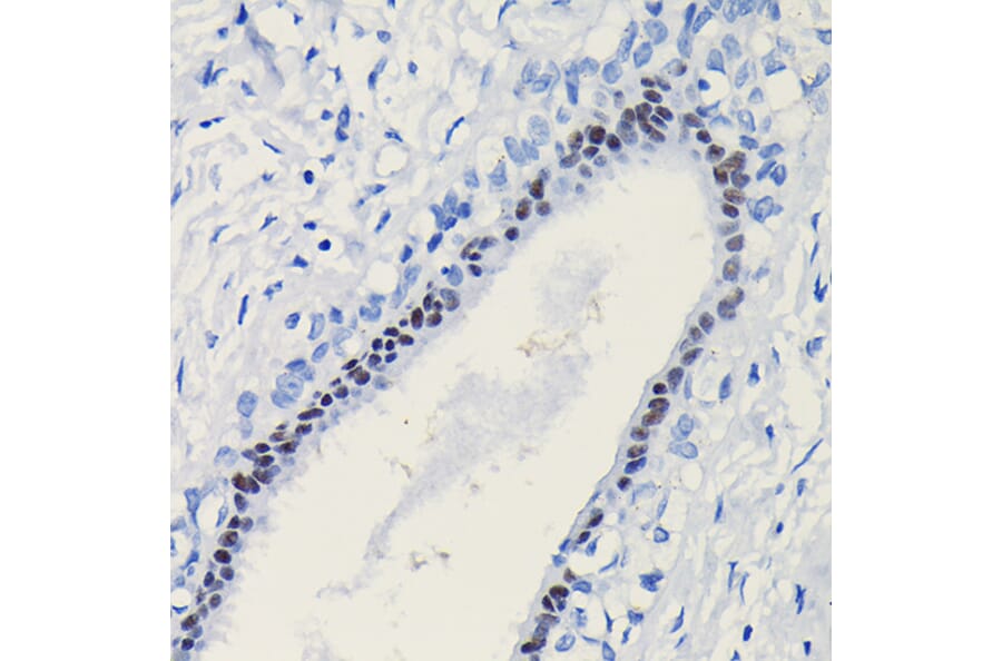 Immunohistochemistry - Anti-Progesterone Receptor Antibody (A81206) - Antibodies.com