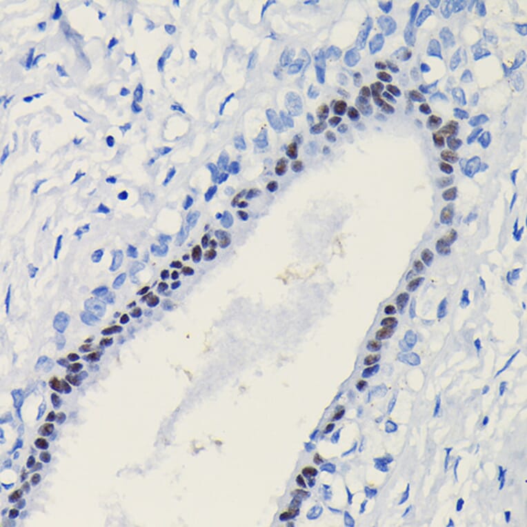 Immunohistochemistry - Anti-Progesterone Receptor Antibody (A81206) - Antibodies.com