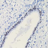 Immunohistochemistry - Anti-Progesterone Receptor Antibody (A81206) - Antibodies.com