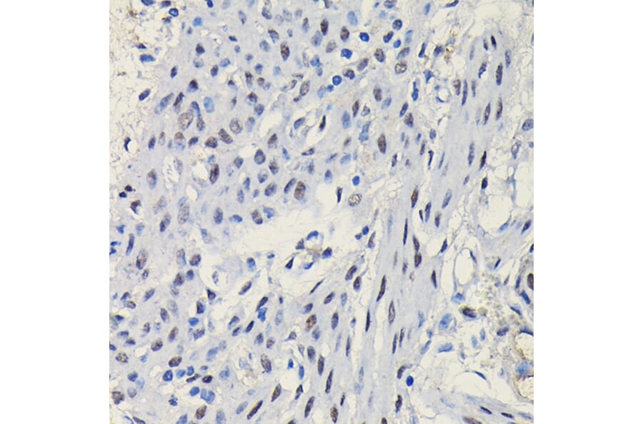 Immunohistochemistry - Anti-Progesterone Receptor Antibody (A81206) - Antibodies.com