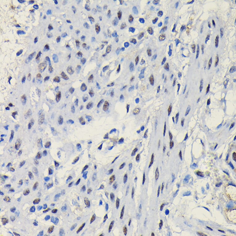 Immunohistochemistry - Anti-Progesterone Receptor Antibody (A81206) - Antibodies.com