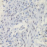 Immunohistochemistry - Anti-Progesterone Receptor Antibody (A81206) - Antibodies.com