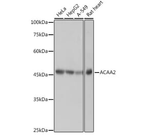 Western Blot - Anti-ACAA2 Antibody [ARC2533] (A81207) - Antibodies.com
